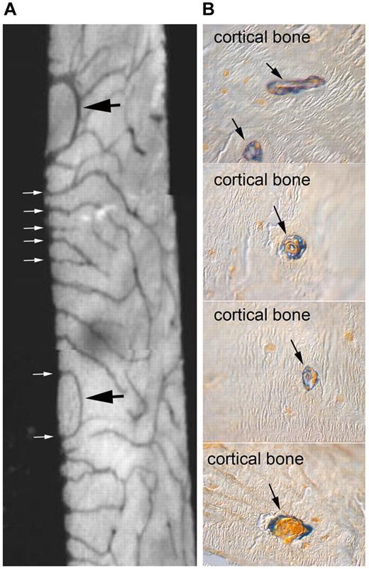 Figure 1. Internal vascularity of rodent bone, its connection with the marrow cavity, and its association with osteogenic cells. (A) Contact microradiograph of a 50-μ section of an 8-week-old rat tibia demonstrating a rich network of intracortical vessels opening in the marrow at the endosteal surface (white arrows). Also note individual vascular spaces looping within bone and reentering the BM (black arrows). (B) Low-temperature processed, glycol methacrylate-embedded, 4-μ thick undecalcified sections of an 8-week-old wild-type mouse tibia stained for ALP activity (blue). Note that intracortical vessels are coated with an adventitial layer of ALP-positive cells.