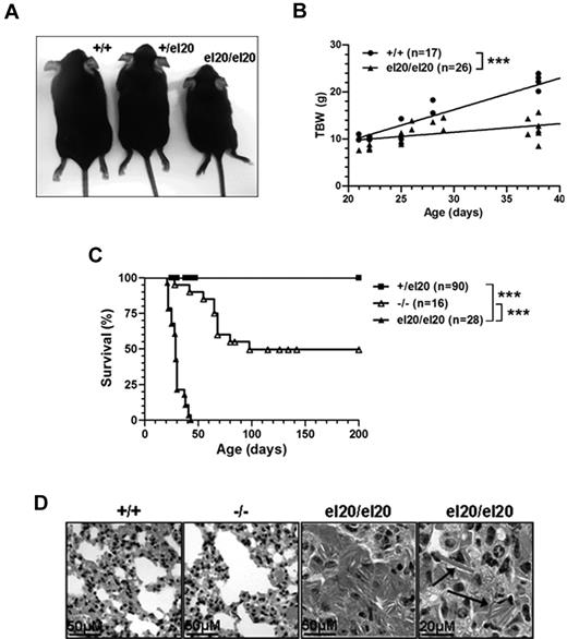 Figure 2. Homozygous SHIP1el20/el20 mice have runting, early lethality, and severe lung disease. (A) Five-week-old sex-matched littermates showing runting of a homozygous SHIP1el20/el20 mouse compared with wild-type SHIP1+/+ and heterozygous SHIP1+/el20 mice. (B) Total body weight (TBW) of male SHIP1el20/el20 mice compared with male SHIP1+/+ controls. ***P < .001 using 1-way ANOVA. (C) Survival curves of SHIP1el20/el20 mice compared with SHIP1−/− and SHIP1+/el20 mice. ***P < .0001 using log-rank (Mantel Cox) test. (D) Hematoxylin and eosin–stained histologic lung sections of 4-week-old SHIP1el20/el20 mice showing alveolar airspace consolidation of lungs with macrophages containing eosinophilic Ym1 crystals (arrows). Normal lungs from age-matched SHIP1+/+ and SHIP1−/− mice are shown.