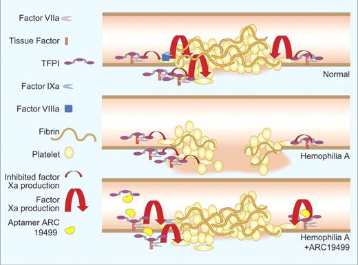 Bleeding from a normal vessel (top) is quenched by a platelet plug stabilized by fibrin strands. Bleeding continues from a hemophilia vessel (middle) because TFPI blocks factor Xa production leaving inadequate factor Xa to drive fibrin formation or platelet activation. Aptamer ARC19499 inhibits tissue factor pathway inhibitor (bottom) enabling the factor VIIa-tissue factor complex to produce sufficient factor Xa to stabilize the platelet plug. Professional illustration by Paulette Dennis.