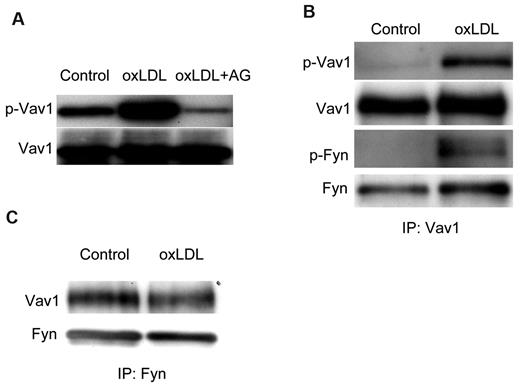 Figure 2. OxLDL-induced Vav1 phosphorylation is mediated by src kinase Fyn. (A) Human platelets were incubated with the broad-spectrum src inhibitor AG1879 before incubation with 50 μg/mL oxLDL. The platelet lysates were then analyzed as in Figure 1 for Vav1 phosphorylation. (B) Platelets were incubated without or with oxLDL and then lysed. Vav1 was precipitated by an Ab specific for Vav1. Precipitates were analyzed by immunoblot with 4G10 anti-phosphotyrosine Ab, Vav1 Ab, and Fyn Ab (mouse). (C) Platelets were incubated without or with oxLDL and then lysed. Fyn was precipitated with an anti-Fyn Ab (mouse). Precipitates were analyzed by immunoblot with Vav1 Ab and Fyn Ab (Rabbit).