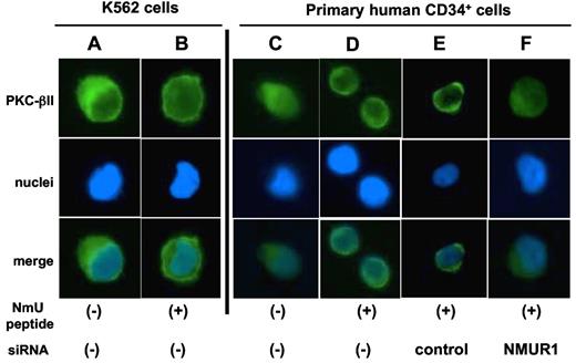 Figure 4. NmU activates PKc-βII in hematopoietic cells. K562 cells were (A) unstimulated or (B) stimulated with NmU peptide for 30 minutes, and the subcellular localization of PKC-βII was detected by immunofluorescence microscopy. A representative image from 5 different fields of view for each condition is shown. Subcellular localization of PKC-βII was also determined in non-nucleofected primary CD34+ cells that were (C) unstimulated or (D) stimulated with NmU peptide for 30 minutes as well as in primary CD34+ cells that were nucleofected with (E) control or (F) NMUR1 siRNA before NmU peptide stimulation for 30 minutes. As with K562 cells, representative images are shown. PKC-βII in unstimulated control and NMUR1 siRNA-treated cells resided in the cytoplasm as shown in panel C (data not shown).