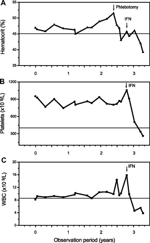Figure 5. Follow-up in a 46-year-old patient clinically presenting as ET with a platelet count of 951 × 109/L, a hemoglobin/hematocrit value at the upper limit, a positive JAK2 mutation status, and an erythropoietin level of 2.0 U/L. There was an increase of the hematocrit and white blood cells (WBC) starting after more than 2 years of observation with manifestation of overt PV requiring treatment with interferon (IFN).