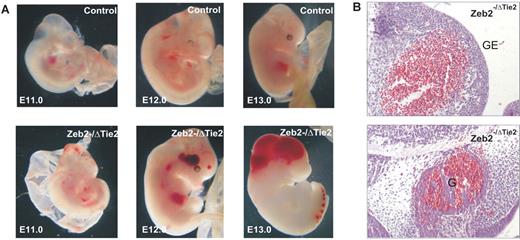Figure 2. Tie2-cre–mediated loss of Zeb2 causes intracranial hemorrhaging at E12.5. (A) Zeb2−/ΔTie2-Cre hemorrhagic phenotype. (B) Hematoxylin/eosin staining of E12.5 Zeb2−/ΔTie2-Cre embryo (200× magnification) showing bleeding especially in the germinal layer and ganglia/ganglionic eminences of the developing brain. GE indicates ganglionic eminence; and G, ganglion.