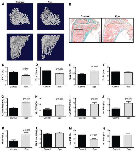 Figure 4. Epo treatment results in a substantial decrease in trabecular bone and increased bone remodeling. (A) Three-dimensional μCT analysis of the secondary spongiosa of proximal tibia depicting a representative top view (top) and side view (bottom) from PBS- and Epo-treated mice, respectively (n = 12 per treatment). (B) Representative sections (original magnification ×25) of 2-dimensional histomorphometric analysis of the same tibial region as in panel A on fixed, plastic-embedded 5-μm sections, stained with (B) Goldeners trichrome, (C-K) toluidine blue, or (L-M) xylenol orange. The box represents the region measured for histomorphometry. Histologic analysis quantification of (C) percentage of bone volume per total volume (BV/TV), (D) trabecular number (Tb.N), (E) trabecular separation (Tb.Sp), and (F) trabecular thickness (Tb.Th). Further quantification of the (G) numbers of osteoclasts per bone perimeter (N.Oc/B.Pm), (H) percentage of bone surface occupied by osteoclasts (Oc.S/BS), (I) numbers of osteoblasts per bone perimeter (N.Ob/B.Pm), and (J) percentage of bone surface occupied by osteoblasts (Ob.S/BS). (K) Quantification of the percentage of unmineralized osteoid volume per bone volume (n = 11 treatment). (L-M) Double-fluorochrome labeling with calcein depicted as (L) mineral appositional rate (MAR), (M) single labeled surface per bone surface (sL.S/BS), and (N) double-labeled surface per bone surface (dL.S/BS) (n = 8 and 11 for PBS and Epo treatment, respectively). All bones were collected 10 days after the first PBS or Epo injection. Data are presented as mean ± SEM.