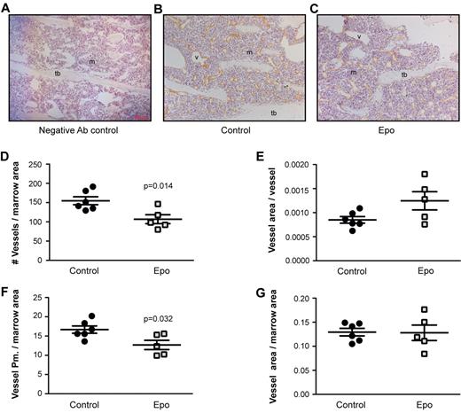 Figure 5. Epo reduces the number of vessels in the BM microenvironment. (A-C) Representative sections (original magnification ×100) in the secondary spongiosa on paraffin sections of tibiae from PBS and Epo-treated mice for immunohistochemistry for the endothelial marker VEGFR3. v indicates vessel; tb, trabecular bone; and m, marrow. (D) Number of vessels per marrow area (total area − bone area). (E) Vessel area per vessel. (F) Total perimeter of vessels per marrow area. (G) Total volume of vessels per marrow area. n = 6 and 5 for PBS and Epo treatment, respectively. Data are mean ± SEM.