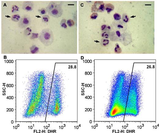 Figure 6. Functional restoration of ROS production in neutrophils differentiated from iXC1-APC-gp91 c3. Panels A and B are cytospin Giemsa stain and DHR flow cytometric analysis, respectively, of neutrophils arising from differentiation of normal control iPSC line iPS(IMR90); and panels C and D are cytospin Giemsa stain and DHR flow cytometric analysis, respectively, of neutrophils arising from differentiation of ZFN-targeted minigene-corrected X-CGD iPSC clone iXC1-APC-gp91 c3. Arrows in the cytospin Giemsa-stain images (A,C) indicate some of the cells with mature neutrophil morphology (bar = 10 μm). The DHR dot plot images (y-axis side scatter; x-axis DHR fluorescence) demonstrate robust ROS production (high fluorescence) by 28.8% and from 26.8% of cells, respectively, representing PMA-activated neutrophils derived from normal control iPSCs (B) and from ZFN-targeted minigene-corrected X-CGD iPSC clone iXC1-APC-gp91 c3 (D).