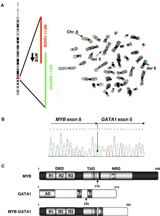 Figure 1. FISH investigation on the MYB gene and structure of MYB-GATA1. (A) Red signal corresponding to RP11-104D9 and spanning the 5′ part of MYB is delocalized on der(X). Localization of BACs on the chromosome 6 is schematized on the left. Normal chromosome 6 (chr.) and derivative chromosomes (der) are indicated. (B) Nucleotide sequence of the fusion mRNA (C) Schematic representation of MYB, GATA1 and MYB-GATA1 proteins. MYB is composed of R1, R2, and R3, which are 3 imperfect 52-residue repeats that encompass the DNA-binding domain (DBD) of MYB. TAD is the transactivation domain of MYB containing a conserved acidic domain and NRD is the negative regulatory domain including a leucine zipper motif (LZ). GATA1 is composed of an activation domain (AD) and 2 zinc finger domains. MYB-GATA1 keeps both the DBD and TAD of MYB and the c-terminal zinc finger domain of GATA1. The breakpoint at the amino acid level is indicated by the black arrow. Of note, the TAD of MYB has lost 9aa (241 to 316) compared with the reference11 (241 to 345) but this portion retains the minimal TAD12 (290 to 315).