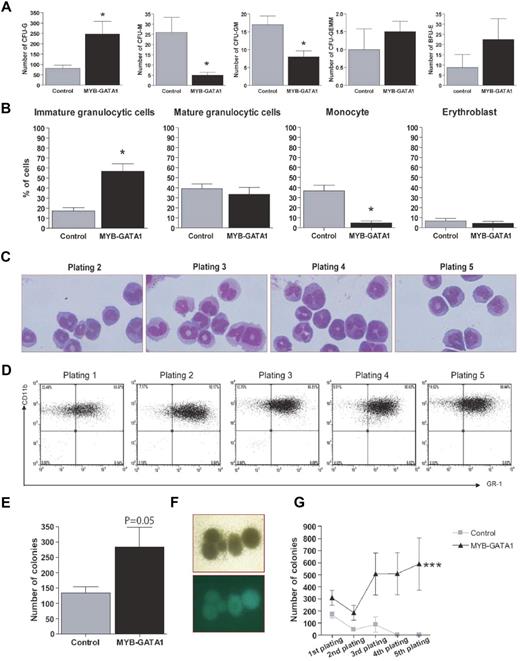 Figure 2. Effects of MYB-GATA1 on differentiation, proliferation and survival. (A) Counting of CFUs at day 12. Each graph represents one type of CFU, as indicated. (B) Identification of various types of cells by staining with MGG. Immature granulocytic cells correspond to undifferentiated blasts, myeloblasts, and promyelocytes; mature granulocytic cells correspond to myelocytes, metamyelocytes, and neutrophils. (C) MGG staining of lin− cells expressing MYB-GATA1 in platings 2-5 shows immature cells with discordant morphologic characteristics (basophilic cytoplasm and lobated nuclei with condensed chromatin). Magnification ×630. (D) FACS analysis of cells transduced with MYB-GATA1 and collected from methylcellulose at each plating. Cells remained CD11b+/GR-1+ throughout. Each graph represents the mean values ± SEM of 4 independent assays. (E) Number of colonies counted after 12 days of differentiation in methylcellulose in MYB-GATA1–transduced lin− cells compared with controls. (F) Image of large and dense colonies of CFU-G when cells were transduced with MYB-GATA1. Magnification ×40. (G) In vitro immortalization assay of transduced lin− cells. At each plating, colonies were counted. Cells transduced with MYB-GATA1 continued to form colonies throughout the 5 platings. Statistical analyses were made using paired t test, for counting of CFU, cells and colonies and 2-way ANOVA for in vitro immortalization assay, *P < .05, **P < .005, and ***P < .001.