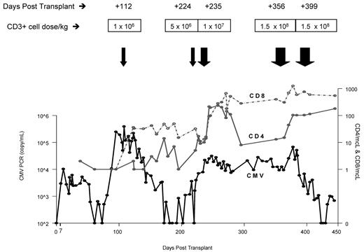 Figure 2. Trend of CMV viral load over time in relation to peripheral blood CD4 and CD8 counts. The viral load less than 500 copies/mL is reported CMV-negative by PCR. CMV antigenemia levels also declined over time in parallel to the decline in CMV viral copy numbers.