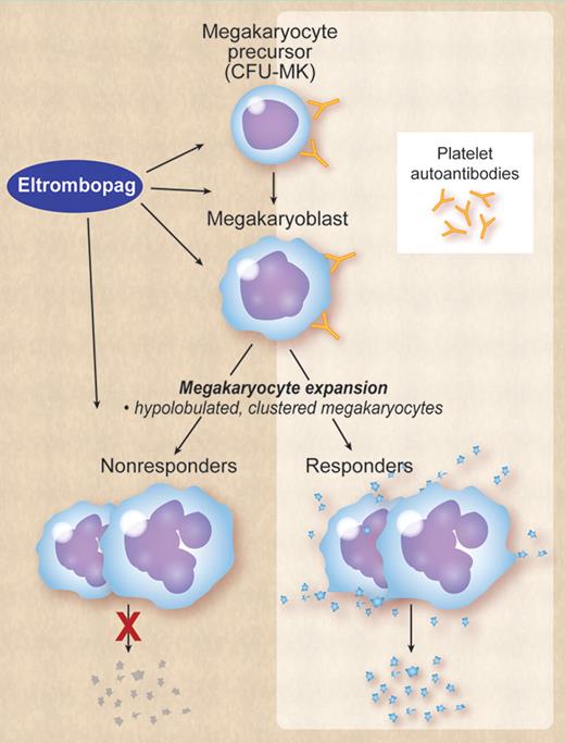 ITP is characterized by autoantibodies to platelet glycoproteins that also bind megakaryocytes and megakaryocyte precursors in the bone marrow, thereby impairing megakaryocyte maturation and proplatelet release. In some patients inhibition of proplatelet release is extreme, in others it is only partial or minimal. Eltrombopag or other TPO-R agonists can stimulate megakaryocyte proliferation and maturation, but has no effect on proplatelet formation and release. Both in responders and nonresponders the bone marrow will show an increased number of megakaryocytes, which tend to be clustered and have a hypolobulated nucleus. The difference between responders and nonresponders is only functional: responders produce platelets, nonresponders do not. Professional illustration by Debra Dartez.