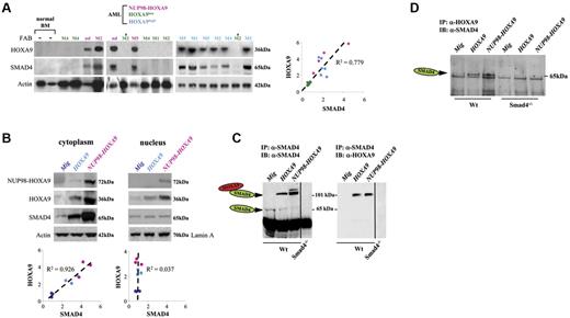 Figure 2. HOXA9 and SMAD4 are coexpressed in human AMLs with NUP98-HOXA9 chromosomal translocation or with high levels in expression of HOXA9 as well as in murine primitive hematopoietic cells immortalized by HOXA9 or NUP98-HOXA9. (A) Western blot analysis of BM cells derived from patients with AML (left panel), using BM from AML patients with low-level expression of HOXA9 (HOXA9low, n = 5), with high-level expression of HOXA9 (HOXA9high, n = 6), or BM samples from AML patients with chromosomal translocation t(7;11)(p15;p15), resulting in NUP98-HOXA9 cytogenetic translocations (NUP98-HOXA9, n = 4). Normal human BM (n = 2) was used as control. Quantification of gel (right panel) reveals a correlation between SMAD4 and HOXA9 intensity. FAB classification is shown on the top (nd indicates not determined). (B) Representative Western blot showing the coregulation of Smad4 and Hoxa9 proteins in murine Wt HSPCs immortalized by HOXA9 (light blue dots) or NUP98-HOXA9 (pink dots) and presentation of the relative increase compared with control samples (Mig vector, blue dark dots) as seen in the right panel. (C) Representative immunoblots showing stabilization of Smad4 and Hoxa9 proteins in Wt HSPCs immortalized by HOXA9 or NUP98-HOXA9. After immunoprecipitation (IP) with the anti-Smad4 antibody and PAGE in the absence of SDS (native condition), the Smad4-Hoxa9 complexes were analyzed by immunoblot (IB) with anti-Smad4 (left) and anti-Hoxa9 (right) antibodies (1 representative experiment of 2 independent experiments). (D) The immunoprecipitation with anti-Hoxa9 antibody and immunoblot (SDS-PAGE) with the anti-Smad4 antibody confirms the presence of Smad4-Hoxa9 complexes in Wt HSPCs immortalized by HOXA9 or NUP98-HOXA9. (B-D) HSPCs (Lin− cells) were isolated from hematopoietic cells generated at serial passage 2 or 3 using CFU assay (HSPCs immortalized by HOXA9 or NUP98-HOXA9). Control HSPCs (Lin− cells) were isolated from hematopoietic cells generated from first passage (HSPCs not immortalized, transduced with Mig).