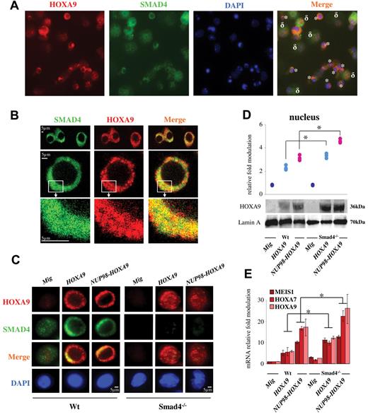 Figure 3. Hoxa9 colocalizes with Smad4 in the cytoplasm of primitive hematopoietic cells immortalized by HOXA9 or NUP98-HOXA9. (A) Transmission microscopy showing the colocalization of Smad4 (green) and Hoxa9 (red) in the cytoplasmic fraction of Wt primitive hematopoietic cells immortalized with HOXA9 (*), while the colocalization is not observed in more differentiated cells (δ). Experiment was performed using total hematopoietic cells immortalized at serial passage 2 or 3 using CFU assay. (B) Confocal microscopy in sequential scanning mode, using a 63× oil-immersion objective showing the colocalization of Smad4 (green) and Hoxa9 (red) in the cytoplasmic fraction of Wt HSPCs immortalized by HOXA9. (C) Immunostaining showing accumulation of Smad4 and Hoxa9 in the cytoplasmic fraction of Wt HSPCs immortalized by HOXA9 or NUP98-HOXA9 (left panel) and cytoplasmic/nuclear localization of Hoxa9 in Smad4−/− HSPCs immortalized by HOXA9 or NUP98-HOXA9 (right panel; representative of 3 individual experiments). (D) Representative Western blot showing increased expression of the Hoxa9 protein in the nucleus of Smad4−/− HSPCs immortalized by HOXA9 (light blue dots) or NUP98-HOXA9 (pink dots) and presentation of the relative increase compared with control samples (Mig vector, blue dark dots), representative of 3 individual experiments. (E) Activation of specific Hoxa9 targets in Smad4−/− HSPCs immortalized by HOXA9 or NUP98-HOXA9 (relative fold change in mRNA expression compared with Wt Mig HSPCs, data show mean ± SEM, n = 4, *P < .01 measured by Student unpaired t test). (B-E) HSPCs (Lin− cells) were isolated from hematopoietic cells generated at serial passage 2 or 3 using CFU assay (HSPCs immortalized by HOXA9 or NUP98-HOXA9). Control HSPCs (Lin− cells) were isolated from hematopoietic cells generated from first passage (HSPCs not immortalized, transduced with Mig).