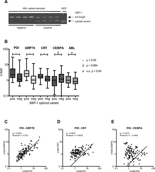 Figure 6. PDI expression is induced in AML patients with activated UPR. (A) XBP1 mRNA spliced variant-specific PCR for negative (lanes 1-4) and positive (lanes 5-8) AML patient samples. U937 cells harvested 24 hours after ER stress induction after treatment with 3 μg/mL tunicamycin served as positive control. (B) Real-time PCR results for mRNAs of PDI, GRP78, calreticulin (CRT), CEBPA, and ABL from AML patient samples stratified according to being positive (n = 31; 25%) or negative (n = 91; 75%) for the XBP1 spliced variant as a marker for activated UPR. (C-E) Correlation between differential gene expression of PDI and GRP78 (C), of PDI and calreticulin (CRT; D), and of PDI and CEBPA mRNAs (E) in 122 AML patients.