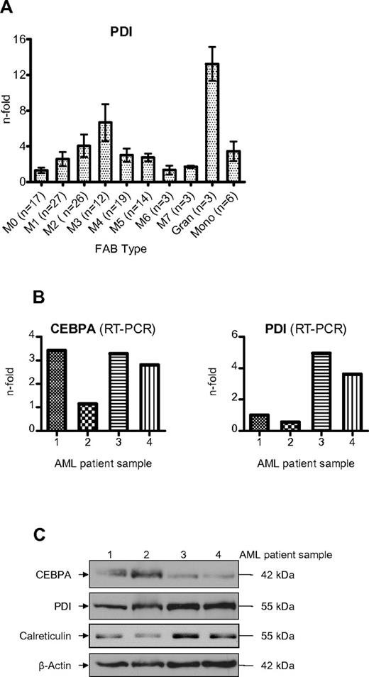 Figure 7. Induction of PDI in AML patients suppresses CEBPA protein. (A) Real-time PCR of PDI mRNA levels in AML patients according to the FAB classification. Mature granulocytes and monocytes from 6 healthy donors are indicated for comparison. Error bars indicate SD. (B) Real-time PCR results of leukemic cells from 4 AML patients for CEBPA and PDI mRNAs. The patients had AML-M2 (#1), -M0 (#2), -M5 (#3), and -M4 (#4). (C) Western blot analysis using whole-cell lysates from blasts of the same 4 AML patients. Membranes were stained with Abs against CEBPA, PDI, and calreticulin. β-actin was used as loading control.