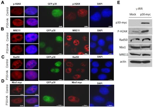 Figure 4. p30 disrupts the formation of the MRN complex on DSB DNA foci. HeLa cells nontransfected or transfected with GFP-p30 (green) were γ-irradiated (10 Gy) and incubated at 37°C. Seven hours later, cells were fixed and stained with antibodies (red) directed against p-H2AX (A), MRE11 (B), Rad50 endogenous proteins (C), or expressed Nbs1-myc tagged protein (D). Cells expressing GFP-p30 have diffused MRN complex proteins compared with nontransfected cells. (E) Relative expression of MRE11, Nbs1, and Rad50 was not affected by the expression of p30. HeLa cells were infected with mock or p30-myc–expressing lentivirus. The titer of the virus was calculated to have 100% of cells infected, and Western blot analysis was performed on the cell extracts using antibodies directed against p-H2AX, MRE11, and Rad50 endogenous proteins or expressed Nbs1-myc.