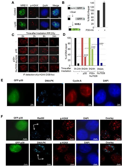Figure 6. p30 induces a switch from the HR to the NHEJ DNA-repair pathway during the S phase. (A) p30 hampers the recruitment of the MRN complex on naturally occurring breaks. HeLa control or p30-expressing cells were stained with anti-MRE11 and anti p-H2AX antibodies to reveal natural breaks. (B) p30 favors NHEJ DNA repair. Representation of the in vivo NHEJ assay based on the EJ5-GFP reporter vector. HeLa cells were transfected with EJ5-GFP and pSceI expression vector with or without p30 expression vector. The percentage of GFP+ cells was estimated by FACS and is represented by the histograms of 3 independent experiments with standard deviations. (C) p30 favors unfaithful DNA repair. HeLa cells infected with mock lentivirus or p30-expressing lentivirus particles were treated or not with the DNA-PK inhibitor Nu7026 (20μM), a specific inhibitor of the NHEJ-repair pathway. Cells were γ-irradiated and the time course of the DNA-repair rate at 0, 2, 8, and 24 hours was performed by immunofluorescence staining with anti–p-H2AX antibody showing the number of breaks in each time condition. (D) DSB foci were counted in at least 30 cells collected by z-stack acquisition at 0 and 24 hours of each condition. Results represent average values. ***P < .001. (E) NHEJ DNA repair is increased in p30-expressing cells. HeLa cells transfected with GFP-p30 were synchronized with hydroxyurea and released for 7 hours to have the majority of cells in the S phase. The cells were then irradiated (10 Gy) and 2 hours later stained with anti-cyclin A (a marker of the S phase) or anti–DNA-PK (a marker of NHEJ) antibodies, followed by Alexa Fluor 568 (red) or Alexa Fluor 647 (blue)–conjugated secondary antibodies, respectively. (F) p30 favors a switch from the HR to the NHEJ DNA-repair. HeLa cells transfected with GFP-p30 were synchronized with hydroxyurea and released for 7 hours to have the majority of cells in the S phase. Cells were irradiated (10 Gy) and 2 hours later stained with anti–p-H2AX (DSB) and either Rad50 (HR-specific) or DNA-PK (NHEJ-specific) antibodies.