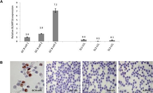 Figure 1. Differential expression of BLIMP1α in normal and transformed GC B cells. (A) Quantitative RT-PCR analysis shows that EBV infection of GC B cells was associated with the down-regulation of BLIMP1α transcription. Shown here are 3 LCLs (SL1-LCL, SL2-LCL, and SL3-LCL) established after the infection of GC B cells isolated from 3 separate donors. (B) Immunohistochemical analysis revealed strong BLIMP1 expression in a subpopulation of the uninfected GC B cells. In contrast, the LCLs showed homogeneously weaker BLIMP1 expression. Magnification ×450. Images acquired with 60×/1.40 NA oil immersion objective lens (Nikon Ltd).