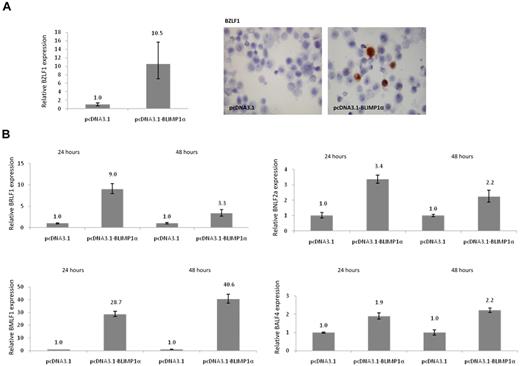 Figure 6. BLIMP1α up-regulates BZLF1 expression and induces lytic cycle in LCLs. (A) Quantitative RT-PCR analysis of BZLF1 mRNA levels in OKU-LCL after transfection with BLIMP1α or empty vector. In all transfected LCLs (n = 5, Table 1), the expression of BLIMP1α was followed by the up-regulation of BZLF1 mRNA. (Left panel) Immunostaining revealed that ectopic BLIMP1α expression increased the frequency of BZLF1-expressing cells. (B) Ectopic expression of BLIMP1α led to the increased expression at 24 and 48 hours of BRLF1, and of the lytic cycle genes, BMLF1, BNLF2a, and BALF4. Shown here are results of OKU-LCL; similar results were obtained after transfection of SAL-LCL and B95.8 cells (data not shown). Image is at magnification of ×450, and was acquired with 60×/1.40 NA oil immersion objective lens (Nikon Ltd).
