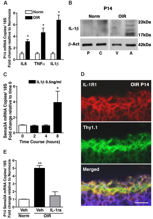 Figure 2. IL-1β in the ischemic avascular retina induces Sema3A expression. (A) The inflammatory cytokines IL-6, TNF-α, and IL-1β are induced in OIR retinas, in particular IL-1β, which was up-regulated 6.8-fold compared with normoxia. n = 3; P < .01 compared with normoxia (Norm). (B) Microdissection of avascular (A) regions of the OIR retina reveals a marked induction in IL-1β (17 kDa) protein levels compared with the vascular regions (V) and the central (C) and peripheral (P) normoxic retina; higher molecular weight bands correspond to pro-IL-1β. n = 3; P < .01 compared with time 0. (C) RGC-5 stimulated with IL-1β (0.5 ng/mL) elicited a delayed (8 hours) but significant 4-fold increase in Sema3A (n = 3-4). (D) Confocal imaging of immunohistochemistry on retinal cross-sections (OIR P14) reveals a predominant expression of IL-1RI by RGCs, as confirmed by merging with RGC marker Thy1.1. (E) IL-1RI antagonist IL-1ra (Kineret) abrogated the OIR-dependent induction of Sema3A compared with vehicle-treated normoxia and OIR controls. Values are the fold increase of control ± SEM. n = 3; **P < .01 compared with normoxic vehicle (Veh). (D) Scale bar represents 25 μm.