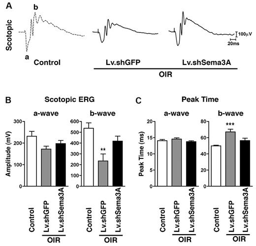 Figure 4. Inhibition of RGC-derived Sema3A during PR preserves neuroretinal function. (A) Representative recordings of full-field scotopic ERGs in response to progressively brighter flashes of white light ranging in intensity from −6.3 to 0.9 log cd/s/m2 in 0.3 log-unit increments (using a photostimulator with an interstimulus interval of 10 seconds, flash duration of 20 μs, and an average of 2-5 flashes). (B) Lv.shSema3A-treated mice show a significant gain in inner-retinal scotopic (mixed cone-rod) b-wave response (418.2 μV; n = 6) compared with control contra-lateral Lv.shGFP μV (234.3; n = 8) injected eyes. **P < .01 and ***P < .001 compared with corresponding controls. Similarly, knockdown of Sema3A enhances the response time to light stimulus, as illustrated by decreased peak times (56.4 ms) with respect to controls (67.1 ms). Inner retinal function as determined by a-wave amplitudes and peak times was not significantly affected.