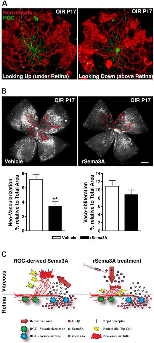 Figure 7. Intravitreal delivery of rSema3A suppresses pre-retinal neovascularization in OIR. (A) 3D reconstructions of pathologic neo-vessels and RGC-YFP at P17 after OIR. The spatial distribution of retinal neurons and vessels results in the repulsion of neovascular tufts toward the vitreous. (B) Intravitreal injection of rSema3A (100 ng; P14) halved the formation of preretinal vascular tufts at P17. n = 7; **P = .0012 compared with corresponding vehicle. (C) Schematic summary illustrates ischemic neurons in the avascular zones, producing Sema3A secondary to inflammatory stress (IL-1β). Pathologic neovascular tufts are enriched in Nrp-1. RGC-derived Sema3A impedes revascularization and repels neo-vessels away from the avascular neural retina toward the vitreous (left), whereas intravitreal rSema3A (injected) prevents preretinal invasion of pathologic neovessels (right).