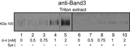Figure 3. Effect of band 3 phosphorylation on its extractability from whole erythrocytes. Erythrocytes were treated with different o-vanadate concentrations for 30 minutes at 37°C in the presence (lanes 6-10) or absence (lanes 1-5) of Syk inhibitors. Released band 3 was then extracted by incubation in 0.5% Triton X-100 at 0°C for 15 minutes, and the soluble fraction was separated from the insoluble membrane skeletons by centrifugation. Extracted proteins in the supernatant were separated by 8% SDS-PAGE, and the band 3 content of the supernatant was visualized by Western blotting using an anti–band 3 antibody.