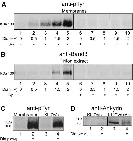 Figure 7. Effect of diamide treatment on tyrosine phosphorylation and extractability of band 3 from erythrocyte membranes. Erythrocyte membrane proteins were separated by 8% SDS-PAGE and analyzed by Western blotting using anti-phosphotyrosine (anti-pTyr), anti–band 3, and anti-Syk antibodies. Gels were run under reducing conditions. (A) Erythrocytes were treated with different concentration of diamide (Dia) for 45 minutes at 37°C in the absence (lanes 1-5) or presence (lanes 6-10) of Syk inhibitors II and IV (Syk I). (B) 0.5% Triton X-100 (0°C for 15 minutes) was added to erythrocytes treated in the absence (lanes 6-10) or presence of Syk inhibitors (lanes 1-5), spun down, and the supernatant (Triton X-100 extract) was collected for Western blot analysis. (C) Membrane proteins and corresponding KI-IOVs (IOVs) obtained from control cells (lanes 1 and 3) and 2 mM diamide–treated cells (lanes 2 and 4). (D) Western blots of pelleted KI-IOVs obtained from control and diamide-treated erythrocytes after their incubation with (lanes 3 and 4) and without (lanes 1 and 2) ankyrin fragment (1nM). Control KI-IOVs (lanes 1 and 3) were obtained from the same experiment showed in Figure 2B. Images were acquired using a laser infrared fluorescence detector (Odyssey; LI-COR Biosciences).