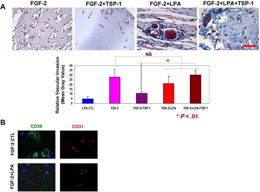Figure 6. LPA abrogates TSP-1–mediated antiangiogenesis in vivo. Matrigel solutions containing FGF-2 (100 ng/mL) alone or in combination with TSP-1 (400 ng/mL) and/or LPA (5μM) were implanted subcutaneously into C57/BL6 mice. After 10 days, the plugs were removed, sectioned, and stained with Masson trichrome to measure neovascularization (A) or antibodies to CD36 (green) and CD31 (red) to assess relative expression levels (B). Vascular invasion was quantified from digital images using ImageJ Version 1.40g software. Representative images are shown in panel A top (scale bar = 50 μm). Bar graph shows mean ± SEM (NS, nonsignificant; *P < .01). Arrows in panel B indicate new blood vessels with weak CD36 expression.