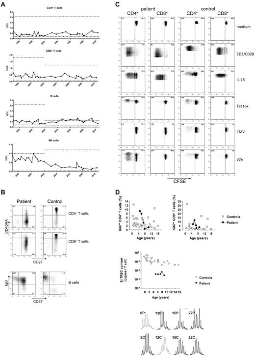 Figure 1. Absolute numbers of CD4+ and CD8+ T cells, CD19+ B cells and CD3−CD16/56+ NK cells over time. (A) Numbers of the patient's lymphocytes are indicated in closed circles; the age-matched control levels for different age categories (ie, 4-10 years; 10-18 years) are indicated in a range of ± 2SD (dotted lines). (B) Immunophenotyping of CD4+ and CD8+ T cells and CD19+CD20+ B cells, according to CD45RA/CD27 and sIgD/CD27, respectively, as compared with a healthy, age-matched control. Proliferative capacity of the patient's T cells. T-cell proliferation of the patient and a healthy control is shown by CFSE dilution after 6 days of culture. Polyclonal proliferation was induced by a combination of CD3/CD28 or IL-15, whereas antigen-specific proliferation was assessed by stimulation with tetanus toxoid (Tet Tox), cytomegalovirus (CMV) or varicella zoster virus (VZV). (C) As expected in the presence of negative serology, CMV antigen did not activate her T cells. Increased proliferation of the peripheral CD4+ T-cell compartment as demonstrated by nuclear Ki67 staining in naive (CD45RA+CD27+) CD4+ and CD8+ T cells, compared with healthy age-matched naive control T cells, as described.13 TRECs in patient's T cells for the early, so-called signal joint (Sj) over a period of 5 years. (D) For T-cell repertoire analysis CDR3 spectratyping in the patient's T cells was analyzed, being representative for 2 separate experiments in triplicate, more than 2 years apart.