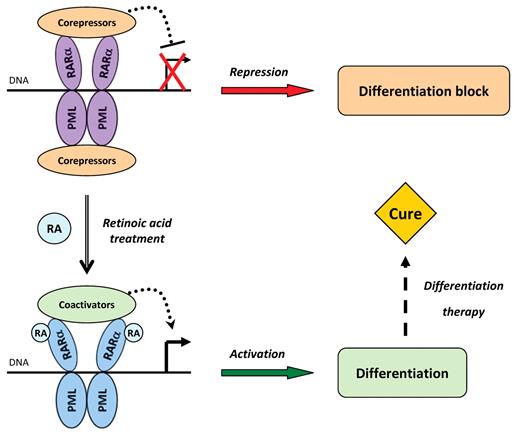 Figure 1. Historical model of PML-RARA-mediated transcriptional repression, RA-induced activation, and differentiation therapy. In the nucleus of APL cells, PML-RARA forms dimers through the coiled-coil domain of PML and binds DNA via its RARA moiety. The complex tightly associates with corepressors, resulting in transcriptional repression of target genes and in differentiation arrest. On exposure to pharmacologic doses of RA, PML-RARA switches to an active conformation and the corepressors are replaced by coactivators, thus enforcing the transcription of target genes, triggering the differentiation process and ultimately leading to cure.