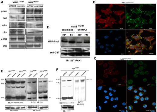 Figure 6. ITGB7 binding to FN activates FAK, Src, and Rac-1. (A) Lysates from ITGB7silenced and ITGB7positive MM1S and H929 cells cultured on FN were screened by immunoblotting for the activation of FAK (phospho-Tyr397-FAK), Src (phospho-Tyr416-Src), and ERK (phospho-Thr202/Tyr204ERK1/2) and loading controls. (B-C) p-FAK localization and distribution in ITGB7positive (B) and ITGB7silenced (C) H929 cell cultures on FN-coated plates and measured by laser scan confocal microscopy. Shown are the images of immunostaining with anti-actin (Red: AlexaFluor 555 phalloidin), anti-phospho-FAK (Green: AlexaFluor 488) and DAPI with overlay images. (D) Rac-1 activation (GTP-Rac1 bound to GST-PAK1-p21-binding domain corresponding to residues 67-150) measured by immunoblotting with Rac-1 Ab on GST-PAK1 immunoprecipitated protein lysates (500 μg) from ITGB7silenced and ITGB7positive MM1S cells cultured under the indicated conditions (RP = regular uncoated plate, FN = fibronectin-coated plates) with anti-GST (Cell Signaling Technology) loading control. (E) Activation of Rac1 was measured in lysates from ITGB7silenced and ITGB7positive MM1S and H929 cells cultured on FN. Pulldowns of activated Rac1 (GTP-Rac1 bound to GST-PAK1 beads) were analyzed by Western blot for Rac1 and reprobed with anti-GST as loading control. Blot on the left represent a Western blot for total Rac1 in 10% of the imput lysate used for the immunoprecipiation of activated Rac1. Rac1-nS1 indicates the up-shifted band of Rac1 corresponding to SUMOylated Rac1. (F) Pulldowns of activated Rac1 (GTP-Rac1 bound to GST-PAK1 beads) from H929 ITGB7silenced and ITGB7positive cells cultured on FN were blotted with anti-SUMO1 Ab. Blot on the left represent a Western blot for total Rac1 in 10% of the input lysate used for IP. GTP-Rac1-nS1 indicates the up-shifted band of Rac1 corresponding to SUMOylated Rac1.