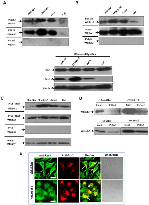 Figure 4. Interaction between endogenous Bcl-2 and Rac1 is enhanced on Bcl-2 overexpression. (A) Whole cell lysates from various tumor cell lines were immunoprecipitated with anti-Bcl-2 and probed with anti-Rac1. Immunoprecipitation with control rabbit anti-IgG antibodies was used as a negative control. (B) Whole cell lysates from tumor cell lines were immunoprecipitated with anti-Rac1 and probed with anti–Bcl-2. Immunoprecipitation with control mouse anti-IgG2b antibodies was used as a negative control. Whole cell lysates probed with anti-Rac1, anti–Bcl-2, and β-actin are shown on the bottom panel. (C) Endogenous Bcl-2 was pulled down with purified recombinant GST-Rac1 using cell lysates from CEM/Neo, CEM/Bcl-2, Jurkat, and Raji cell lines. The proteins were immunoblotted with anti–Bcl-2 (first panel) and anti-Rac1 (second panel). Pulldown with GST was used as a negative control. (D) Lysates from Jurkat/Neo, Jurkat/Bcl-2, HeLa/Neo, and HeLa/Bcl-2 were immunoprecipitated with anti-Rac1 and probed with anti–Bcl-2. (E) Representative confocal microscopy of Bcl-2 expression and Rac1 expression in HeLa/Bcl-2 cells. Rac1 was probed with anti-Rac1 and fluorescein isothiocyanate-conjugated secondary mouse IgG, whereas Bcl-2 was probed with anti–Bcl-2 and rhodamine-conjugated secondary rabbit IgG. The panels were merged using Fluoview (FV10-ASW.1.3 viewer) software to detect areas of colocalization of Rac1 and Bcl-2 proteins. Bar represents 20 μm. All experiments were performed at least 3 or more times independently.