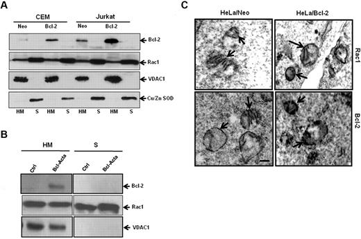 Figure 5. Rac1 localizes to the mitochondrial membranes. (A) Jurkat and CEM cells overexpressing Bcl-2 (30 × 106) were lysed and fractionated into purified heavy membrane (HM) and cytosolic (S) fractions. The fractions were then probed for VDAC1, Bcl-2, Rac1, and Cu/Zn SOD. (B) Rat cell lines overexpressing Bcl-2 targeted to the mitochondria (30 × 106) were lysed and fractionated into purified heavy membrane (HM) and cytosolic (S) fractions. The fractions were then probed for VDAC1, Bcl-2, and Rac1. (C) Representative electron micrographs of HeLa/Neo and HeLa/Bcl-2 cells. The cells were stained with anti-Rac1 and anti–Bcl-2 antibodies and prepared for electron microscopy as described in “Immunochemical staining and transmission electron microscopy.” Arrows point to immunoreactive regions on the mitochondria showing the presence of Rac1 and Bcl-2 on the inner and outer mitochondrial membranes of HeLa/Neo and HeLa/Bcl-2. Bar represents 1 μm. Data presented are representative of at least 3 independent experiments.