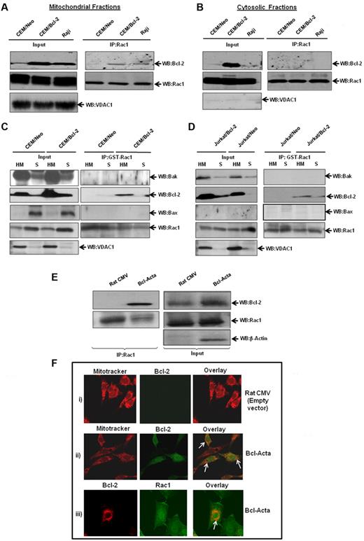 Figure 6. Increased interaction between endogenous Bcl-2 and Rac1 at the mitochondrial membranes. (A) Mitochondria-enriched fractions from CEM/Neo, CEM/Bcl-2, and Raji cells were immunoprecipitated with anti-Rac1 and probed with anti–Bcl-2 by Western blotting. The mitochondrial input was probed with anti-VDAC1. (B) Cytosolic fractions from CEM/Neo, CEM/Bcl-2, and Raji cells were immunoprecipitated with anti-Rac1. The proteins were then immunoblotted with anti–Bcl-2 (first panel) and anti-Rac1 (second panel) antibodies. The input shows the presence of Rac1 in the cytosolic fractions of CEM/Neo, CEM/Bcl-2, and Raji cells. (C-D) GST-pulldown was done using mitochondria-enriched (HM) and cytosolic fractions (S) from CEM/Neo, CEM/Bcl-2, Jurkat/Neo, and Jurkat/Bcl-2 using GST-Rac1. The membranes were then immunoblotted with anti-Bak (first panel), anti–Bcl-2 (second panel), and anti-Bax (third panel) antibodies. The input was probed for VDAC1 to show purity of mitochondrial fractions. (E) Lysates from rat cytomegalovirus (CMV; control plasmid) or Bcl-Acta were immunoprecipitated with anti-Rac1 and probed for Bcl-2. Inputs are shown in the right panel. (F) Rat CMV or Bcl-Acta cells were loaded with Mitotracker and anti–Bcl-2 or anti-Rac1 as described in “Immunofluorescence by confocal microscopy” and analyzed for colocalization by fluorescence confocal microscopy. Data presented are representative of at least 3 independent experiments.