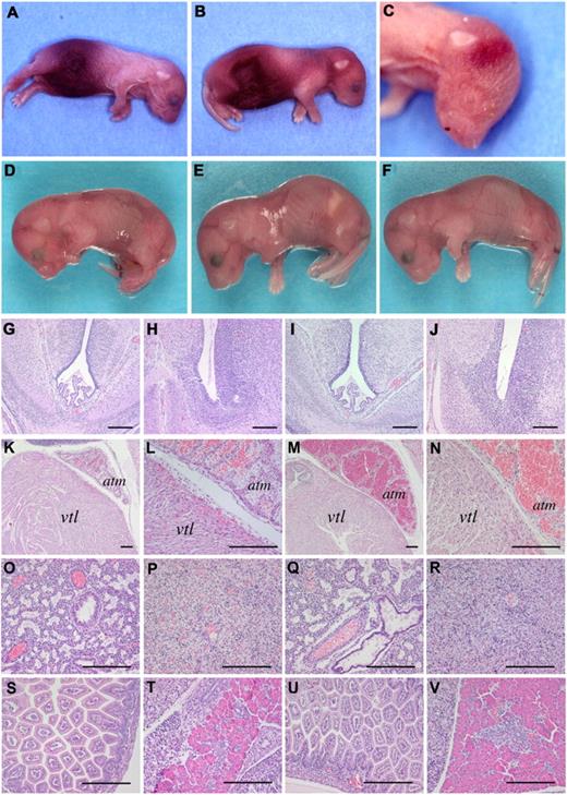 Figure 2. Mice homozygous for fIIWE complete embryonic development but uniformly experience fatal postnatal bleeding events. (A-C) Representative examples of fIIWE/WE homozygous neonates. Note that most of the fIIWE/WE postnatal animals displayed appreciable abdominal hemorrhage. In addition, subcutaneous bleeding events in the head and neck region were also routinely observed. (D-F) Representative examples of fIIWT/WT, fIIWT/WE, and fIIWE/WE embryos, respectively, collected at E18.5. Each animal was alive at the time of harvest, macroscopically normal, and free of overt hemorrhage. (G-V) Microscopic analysis revealing a normal pattern of development with no signs of hemorrhage in any organ system of fIIWE/WE offspring at E18.5. Note that hematoxylin/eosin–stained sections prepared from embryonic brain (G-J), heart (K-N), lung (O,Q), liver (P, R), small intestine (S,U), and pancreas (T,V) were virtually indistinguishable in wild-type offspring (panels G, H, K, L, O, P, S, T) and homozygous fIIWE/WE offspring (panels I, J, M,N, Q, R, U, V). The heart ventricle and atrium are annotated by vtl and atm, respectively. The scale bar indicates 100 μm.