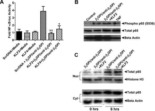 Figure 3. Expression of KLF2 or KLF4 inhibits NF-κB transcriptional activity in APLA/anti-β2GPI–treated endothelial cells. (A) Endothelial cells were transfected with expression vectors containing scrambled DNA (Scr DNA, control), or KLF2 or KLF4 cDNA along with an NF-κB–luciferase reporter and Renilla luciferase (as a transfection efficiency control). Transfected cells were subsequently incubated with medium alone, β2GPI (100nM) and anti-β2GPI antibodies (600nM), or TNF-α (10 ng/mL) for 5 hours before measurement of luciferase activity. NF-κB transcriptional activity was determined from measured NF-κB luciferase activity normalized to Renilla. Expression of KLF2 and KLF4 inhibited NF-κB transcriptional activity in the presence of β2GPI/anti-β2GPI antibodies compared with control cells (**P < .004 and *P < 0.04, respectively). Error bars represent the mean ± SEM of triplicate points, and data are representative of 4 experiments. (B) KLF2 expression does not inhibit phosphorylation of p65 serine 536. Endothelial cells were transfected with expression vectors containing scrambled DNA (Scr DNA, control), or KLF2 cDNA and subsequently treated as in panel A. Cell extracts were prepared, and 80 μg of total protein was separated using 7.5% SDS-PAGE, transferred to PVDF, and blotted with rabbit anti–human antibodies to phospho-p65 (serine 536) and total p65. (C) KLF2 expression does not block nuclear translocation of NF-κB p65. Endothelial cells were transfected and treated as in panel B. Nuclear (Nuc) and cytoplasmic (Cyt) extracts were prepared, and 40 μg of protein from each was separated by 7.5% SDS-PAGE, transferred to PVDF, and blotted with rabbit anti–human p65. Transfection of endothelial cells with a KLF4 expression vector yielded identical results as seen with KLF2 in panels B and C.