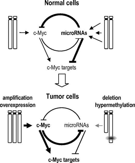 Figure 7. A model of the GIs between Myc, its targets, and miRNAs in normal and tumor cells. In normal cells, multiple miRNAs are expressed that can repress Myc or Myc targets. miRNA genes are not repressed by Myc because of the low levels of Myc signaling in normal cells. Tumor cells acquire diverse genetic or epigenetic alterations that result in the overexpresssion of Myc and Myc targets to facilitate tumor development through diverse cellular processes. On one hand, Myc can be amplified and overexpressed. On the other hand, miRNAs are silenced by genetic (loss of heterozygosity), epigenetic (hypermethylation), or regulatory (repression by Myc) mechanisms. Because of the low levels of these miRNAs, signaling by Myc and Myc targets is enhanced resulting in dramatic deregulation of the cell cycle, protein translation, and metabolism among other cellular processes. This model is mostly based on the results obtained by Chang et al19 on the repression of miRNAs by Myc and the control of Myc by miRNAs reported here.