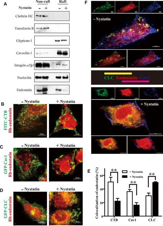 Figure 3. Nystatin switches endostatin internalization from caveolae/lipid rafts to clathrin-coated pits. (A) HUVECs were treated with 0 or 25 μg/mL nystatin, incubated with 5 μg/mL endostatin at 37°C for 30 minutes, and lysed with 1% Triton X-100 on ice for 30 minutes. Triton X-100 flotation gradients were prepared with a 5%/30%/40% OptiPrep gradient. Clathrin heavy chain (Clathrin HC) and transferrin receptor (Transferrin R) were used as markers for nonraft fractions. Cav1 and glypican-1 were used as markers for raft fractions. (B) HUVECs were treated with 0 or 25 μg/mL nystatin, then incubated with 2 μg/mL FITC-CTB and 5 μg/mL Rh-endostatin at 37°C for 30 minutes. Cells were further fixed and examined by a confocal microscope. (C-D) HUVECs were transfected with GFP-Cav1 or GFP-clathrin light chain (CLC) for 48 hours. Cells were then treated with 0 or 25 μg/mL nystatin and incubated with 5 μg/mL Rh-endostatin at 37°C for 30 minutes. (E) The levels of colocalization (B-D) were quantified by calculating the percentage of red pixels (Rh-endostatin) that colocalized with green pixels (FITC-CTB, GFP-Cav1, or GFP-CLC) from ≥ 8 random fields per well of 3 experiments. (F) Triple fluorescent staining with GFP-CLC (green), Rh-endostatin (red), and anti-Cav1 primary Ab followed by a cyanine 5–conjugated secondary Ab (blue) in the absence or presence of nystatin. Images were obtained using a Nikon A1 microscope (60×/1.40 NA oil objective). Scale bar, 10 μm. **P < .01. Error bars represent SEMs.
