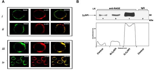 Figure 5. β2GPI association with RAGE on the iDC surface. (A) Scanning confocal microscopic analysis of β2GPI association with RAGE on iDC surface. (A) Cells were fixed in 4% formaldehyde in PBS and then labeled with a polyclonal anti-β2GPI Ab and with a monoclonal anti-RAGE Ab, followed by Texas Red-conjugated anti–goat or FITC-conjugated anti–mouse Ab. Panel i shows β2GPI-RAGE association in untreated (control) cells. One representative cell is shown. Panel ii shows β2GPI-RAGE association in cells treated with M-β2GPI. One representative cell is shown. Panel iii shows β2GPI-RAGE association in cells treated with G-β2GPI. One representative cell is shown. Panel iv shows β2GPI-RAGE association in cells treated with G-β2GPI. A group of cells is shown. (B) Coimmunoprecipitation analysis of β2GPI association with RAGE on the iDC surface. Cells were incubated with M-β2GPI or G-β2GPI and then immunoprecipitated with anti-RAGE mAb. The immunoprecipitates were analyzed by Western blotting using an anti β2GPI polyclonal Ab. Lane a shows the reactivity of anti-β2GPI with RAGE immunoprecipitate from untreated cells. Lane b shows the reactivity of anti-β2GPI with RAGE immunoprecipitate from M-β2GPI–stimulated cells. Lane c shows the reactivity of anti-β2GPI with RAGE immunoprecipitate from G-β2GPI–stimulated cells. Lane d shows the reactivity of anti-β2GPI with immunoprecipitate with IgG with irrelevant specificity from untreated cells.