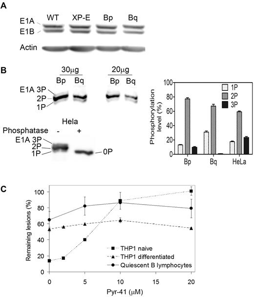 Figure 4. Ube1 phosphorylation and impact on NER in quiescent B lymphocytes. (A) Representative immunoblot showing the amount of ubiquitin-activating enzyme Ube1 in 50 μg of total cell lysate from wild-type (WT) or XP-E lymphoblasts, and from proliferating (Bp) or quiescent (Bq) B lymphocytes (n = 20 donors). Western blotting was performed with an antibody directed against both the E1A (full length, phosphorylated) and E1B (truncated) isoforms of Ube1. Beta-actin was used as a loading control. (B) Top, Mobility shift detection of phosphorylated forms of Ube1 isoform E1A, 3 phosphate (3P), 2 phosphate (2P), and 1 phosphate (1P) in proliferating and quiescent B lymphocytes. Cell lysates were run on a 6% SDS-PAGE containing 50μM of acrylamide-coupled phosphate chelator (PhosTag) and analyzed by Western blotting with an antibody specific for the E1A isoform. Bottom, His-tagged Ube1 was purified from Hela cells, treated or not treated with λ phosphatase, and analyzed as described previously. The phosphatase-treated sample reveals the position of nonphosphorylated Ube1 (0P). Right, Quantification of the phosphorylated forms of Ube1 isoform E1A in proliferating and quiescent B lymphocytes and of purified Ube1 with ImageGauge software. Data are representative of 3 experiments and shown as mean ± SEM. (C) Effect of the Ube1-specific inhibitor Pyr-41 on repair of (6-4)PPs at 3 hours after irradiation in naive and differentiated THP1 leukemia cells, and in quiescent B lymphocytes (n = 6 donors).