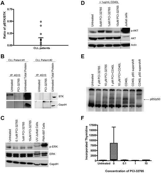 Figure 5. PCI-32765 antagonizes BCR dependent signaling pathways and cell proliferation. (A) CD19+ cells from CLL patients (N = 12) were immunoprecipitated for 4G10. BTK phosphorylation at tyrosine sites was then evaluated by immunoblot analysis. Quantification was done using the Alpha Innotech FluorChemQ MultiImage III system. Dark line represents average. (B) CD19+ cells from CLL patients (N = 4) were treated with and without 10μM PCI-32765 for 2 hours. Cells were immunoprecipitated with 4G10 phospho-tyrosine antibody. BTK phosphorylation at tyrosine sites was then evaluated by immunoblot analysis. Results are shown from 1 of 4 experiments. (C) CD19+ cells from CLL patients (N = 7) were incubated with various concentrations of PCI-32765 for 1 hour. ERK phosphorylation at Thr202/Tyr204 was assessed by immunoblot. Results are shown from 1 of 3 experiments. (D) CD19+ cells from CLL patients (N = 4) were incubated with 1 or 10μM PCI-32765 and/or 1 μg/mL CD40L for 1 hour. AKT phosphorylation at ser473 was assessed by immunoblot. Results are shown from 1 of 3 experiments. (E) CD19+ cells from CLL patients (N = 3) were incubated with 10μM PCI-32765 and/or 1 μg/mL CD40L for 1 hour. EMSA analysis was done with nuclear extract using a radio-labeled oligonucleotide containing a consensus NF-κB binding site. Antibody shifts were performed from CD40L treated sample incubated with antibodies specific to the p65 or p50 subunits of NF-κB. The p65/p50 complex is indicated. Results are shown from 1 of 3 experiments. (F) CD19+ cells from CLL patients (N = 7) were incubated with or without 10μM PCI-32765 and 3.2μM CpG685. Proliferation was assessed by tritiated thymidine incorporation.