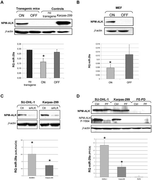 Figure 2. MiR-29a expression is dependent on NPM-ALK. Using murine conditional models NPM-ALK fusion protein expression was analyzed by Western blotting (A) in lymph nodes of conditional NPM-ALK transgenic mice and (B) in MEF NPM-ALK cells in on and off conditions. β-actin was used as a loading control. In both models, miR-29a was detected by RT-qPCR in on and off conditions (histograms). Data are representative of 3 independent experiments. P for on vs off (*P < .05). (C) Human ALCL ALK+ cell lines (SU-DHL-1 and Karpas-299) were transiently transfected with an anti-ALK siRNA (siALK) or a control siRNA (Ctl) and inhibition of NPM-ALK protein expression was assessed by Western blotting. (D) ALCL cells were treated with an NPM-ALK inhibitor (PF-2341066) and its autophosphorylation status was detected with an antibody directed against phosphorylated-tyrosine 664 (NPM-ALK P-Y664). β-actin was used as a loading control. Expression levels of miR-29a, by RT-qPCR in ALCL cell lines after transfection with siALK (C) or treatment with PF-2341066 (D) are presented as the ratio of RQ (siALK/Ctl) and RQ (PF/Ctl) respectively. P for siALK vs Ctl and PF vs Ctl (*P < .05).