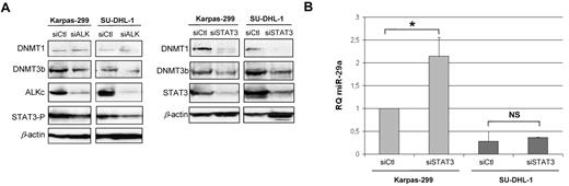 Figure 4. DNMT and STAT3 role in miR-29a low-expression. (A) DNMT1 and DNMT3b endogenous expression in ALK+ ALCL cell lines were detected by Western blotting following NPM-ALK or STAT3 knockdown by siRNA. (B) RQ miR-29a after inhibition of STAT3 in Karpas-299 and SU-DHL-1 cells. P for siCtl vs siSTAT3 in Karpas-299 (*P < .05). NS: not significant.
