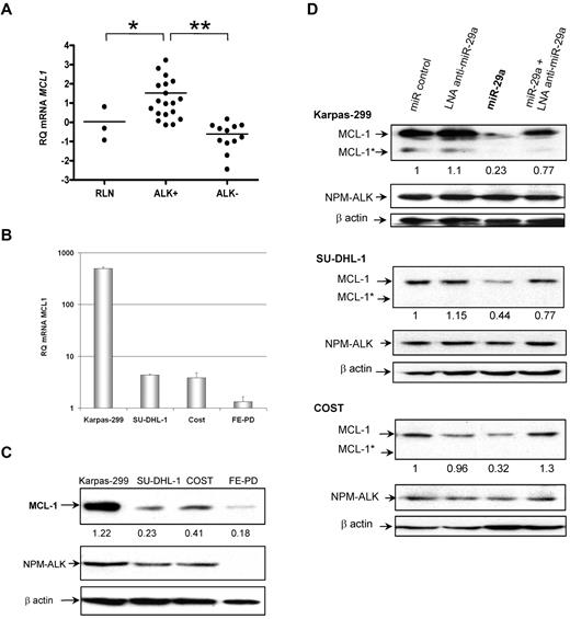 Figure 5. MiR-29a targets MCL-1 in NPM-ALK+ ALCL cells. (A) mRNA levels of Mcl-1 in ALK+ (19 cases) and ALK− (12 cases) ALCL tumors by RT-qPCR. Three RLNs serve as controls. RQ of Mcl-1 was calculated using the S14 as standard control. P for ALK+ vs RLN and ALK+ vs ALK− (*P < .05). MCL-1 endogenous expression in ALCL cell lines is shown in panel B by RT-qPCR with RQ plotted on a logarithmic scale and in panel C by Western blotting with the ratio of MCL-1/βactin. (D) MCL-1 protein levels were monitored 72 hours after Karpas-299, SU-DHL-1, and COST transfection with 1 or 2 (1:1 ratio) of the following: miR negative control, miR-29a, or LNA-anti–miR-29a. The long isoform of MCL-1 (40 kDa) was mainly detected. β-actin was used as a loading control to determine the relative expression of MCL-1 (long MCL-1 at 40 kDa and short MCL-1* at 28 kDa forms added) as the ratio of MCL-1/β actin. Data are representative of 3 independent experiments.