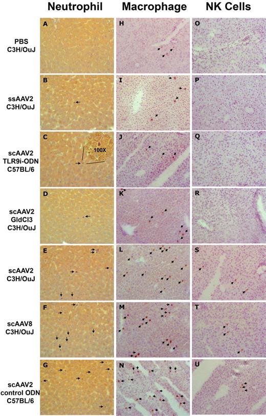 Figure 6. Cellular infiltrates in liver sections 2 hours after vector administration (representative examples). (A-G) Neutrophils. (H-N) Macrophages. (O-U) NK cells. (A) C3H-OuJ control mice injected with PBS. Other panels shown are for hepatic gene transfer with ssAAV2-hF.IX in C3H-OuJ (B, I, P), scAAV2-hF.IX/TLR9i ODN in C57BL/6J (C, J, Q), scAAV2-GFP/GldCl3-treated C3H-OuJ (D, K, R), scAAV2-hF.IX in C3H-OuJ (E, L, S), scAAV8-GFP in C3H-OuJ (F, M, T), or (G) scAAV2-hF.IX/TLR9 control-ODN in C57BL/6J mice (G, N, U). Original magnification: ×40 (neutrophils) or ×20 (macrophages and NK cells).