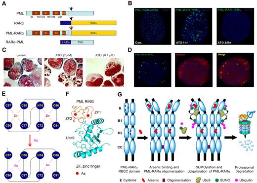 Figure 2. Effects of arsenic on APL cells. (A) Schematic represents the structure of PML, RARα, and PML-RARα. (B) The NB4 cells were treated with 1μM ATO for indicated time points and were assessed by immunofluorescence staining with an anti-PML antibody (green). Stainings were analyzed using a Leica TCS SP5 confocal microscope equipped with a 63×/1.4 NA oil objective (Leica Microsystems). Images were processed using Leica AF lite software. (C) Arsenic induces dual effects on APL cells. The NB4 cells were treated with indicated concentration for 48 hours and stained with the Wright stain. Stainings were analyzed using an Olympus BX51 research microscope equipped with a 100×/1.30 NA oil objective (Olympus). Images were processed using Adobe Photoshop CS (Adobe Systems). Original magnification, ×1000. (D) Colocalization of PML and PML-RARα with the fluorescent organic arsenical ReAsH in NB4 cells. Images were visualized and processed using the equipment described for panel B. (E) The schematic diagram of the structure of PML RING coordinated with zinc or arsenic. (F) Predicted structure of PML RING/UBC9 complex. (G) A working model of the mechanism by which arsenic controls the fate of PML and PML-RARα.