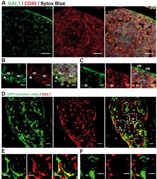 Figure 2. GAL1 is expressed by BM stromal cells. (A) BM sections of wild-type mice were stained with anti-GAL1, anti-CD45, and Sytox Blue (nuclei) (original magnification ×40). Bar represents 10 μm. (B-C) Representative regions of BM sections stained as in panel A (original magnification 63×/1.4 NA oil objective). Hematopoietic cells (arrow), reticular cells (arrowhead), and osteoblasts (ob) expressing GAL1 are designated. Bar represents 20 μm. (D) BM sections of stroma-GFP mice were stained with anti-GFP and anti-GAL1 antibodies (original magnification 40×/1.3 NA oil objective). *Characteristic cuboid or fibroblatic-like GAL1+ stromal cells are indicated. Bar represents 10 μm. Hatches boxes indicate the areas magnified in lower panels. GAL1+ (E) and GAL1− (F) stromal cells are shown. Bar represents 20 μm. Images acquired on Zeiss LSM510 Meta and analyzed with ImageJ 1.44.