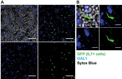 Figure 5. IL-7+ and GAL1+ stromal cells constitute distinct stromal cell populations. BM sections of IL-7-GFP reporter mice were stained with anti-GAL1, anti-GFP antibodies, and Sytox Blue (nuclei) as indicated and analyzed by confocal microscopy. (A) GFP+ IL-7–expressing stromal cells and GAL1+ cells are scattered in the BM (original magnification 40×/1.25 NA oil objective). Bar represents 50 μm. (B) Representative IL-7+ spindle-shaped stromal cell (original magnification 63×/1.4 NA oil objective). Bar represents 10 μm. Images acquired on Leica SP5X and analyzed with ImageJ 1.44.