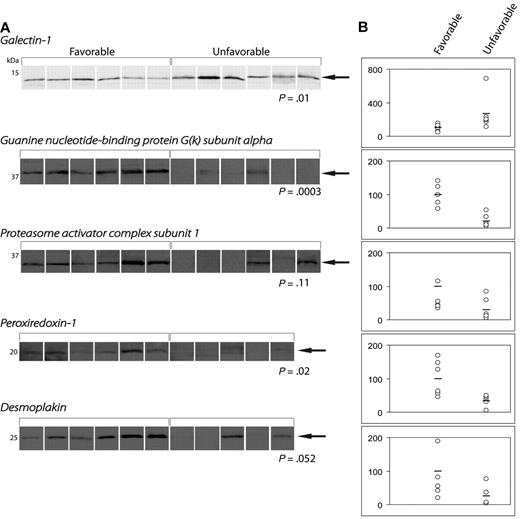Figure 3. Quantification of protein expression by Western blotting. (A) WBs of differentially expressed proteins. (B) Dot-plots demonstrating the band intensities according to treatment outcome.