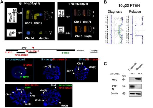 Figure 3. Analysis of T-ALL case no. 28 at diagnosis and relapse. (A) Top panel, identification of the t(1;14)(p32;q11) and a new cryptic t(7;8)(q34;q24) by R-Banding and M-FISH. M-FISH chromosome painting is shown in false color view with fluorescence profiles. Middle panel, chromosomal mapping of the t(7;8)(q34;q24) around MYC by FISH. (i) Interphase nucleus hybridized with the dual color MYC break apart fluorescence in situ hybridization probe (the 5′ probe is located immediately 5′ of MYC, and the 3′ probe ∼ 1.5 Mb 3′); (ii) metaphase FISH analysis with BAC clone RP11-440N18. The leukemic nuclei are identified by the presence of the der1 in DAPI image; (iii) metaphase fluorescence in situ hybridization analysis with BAC clone RP11-125A17. Bottom panel, metaphase FISH mapping with BAC clone RP11-701D14 (T-cell receptorβ) and CEP8 (left image), and BAC clones RP11-701D14 and RP11-125A17 (3′ MYC; right image), confirming reciprocal fusion between T-cell receptorβ and the 3′region of MYC. (B) Array Comparative Genomic Hybridization profiles of chromosome 10 at diagnosis and relapse. The arrow indicates the anomaly at the 10q23 region. Right, a zoom on the 10q23 region is shown. Homozygous and heterozygous deletions had ratios of −1 and −4 respectively. (C) Western blot analysis of MYC and PTEN proteins at diagnosis and relapse. The MYC transcript levels normalized to ABL are indicated on the top of the blots.